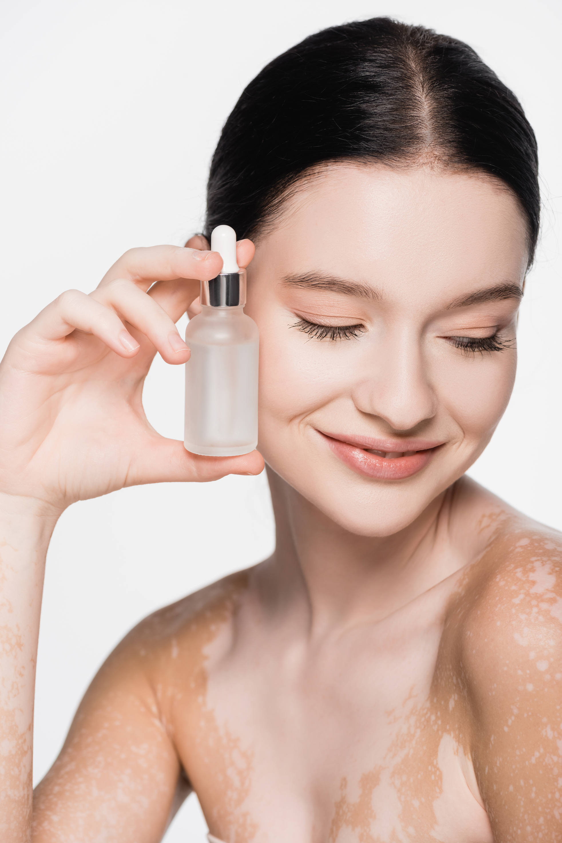 smiling young beautiful woman with vitiligo holding bottle with serum sample